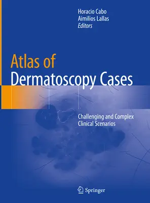 A bőrgyógyászati esetek atlasza: Kihívást jelentő és összetett klinikai esetek - Atlas of Dermatoscopy Cases: Challenging and Complex Clinical Scenarios