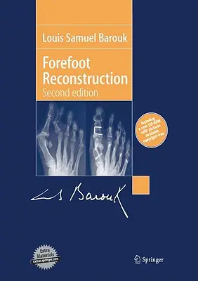 Lábujj-rekonstrukció - Forefoot Reconstruction