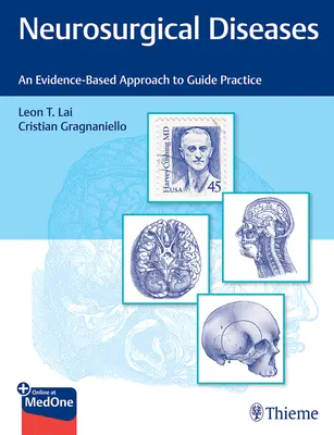 Idegsebészeti betegségek: Egy bizonyítékokon alapuló megközelítés a gyakorlat irányításához - Neurosurgical Diseases: An Evidence-Based Approach to Guide Practice