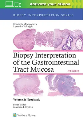 A gyomor-bél traktus nyálkahártyájának biopsziás értelmezése: 2. kötet: Neoplasztikumok - Biopsy Interpretation of the Gastrointestinal Tract Mucosa: Volume 2: Neoplastic