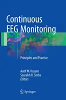 Folyamatos Eeg-monitorozás: EEG: Alapelvek és gyakorlat - Continuous Eeg Monitoring: Principles and Practice