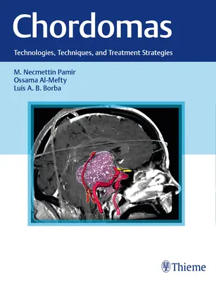 Chordomák: Technológiák, technikák és kezelési stratégiák - Chordomas: Technologies, Techniques, and Treatment Strategies