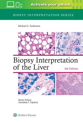 A máj biopsziájának értelmezése - Biopsy Interpretation of the Liver