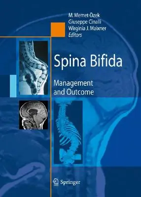 Spina bifida: Binaida Spinida: Kezelés és kimenetel - Spina Bifida: Management and Outcome