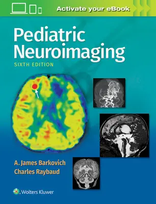 Gyermekkori neuroképalkotás - Pediatric Neuroimaging