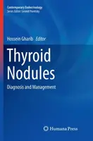 Pajzsmirigy csomók: Pajzsmirigy: Diagnózis és kezelés - Thyroid Nodules: Diagnosis and Management