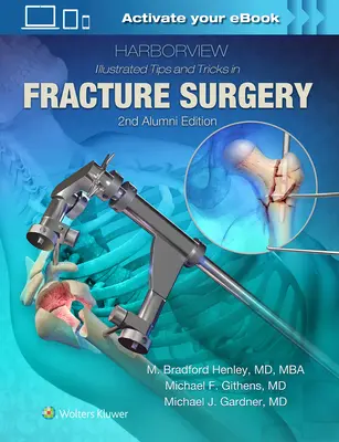 Harborview illusztrált tippek és trükkök a töréssebészetben - Harborview Illustrated Tips and Tricks in Fracture Surgery