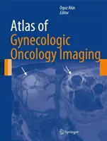 A nőgyógyászati onkológiai képalkotás atlasza - Atlas of Gynecologic Oncology Imaging