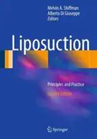 Zsírleszívás: Alapelvek és gyakorlat - Liposuction: Principles and Practice