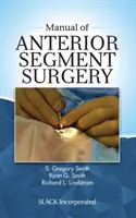 Az elülső szegmentum sebészet kézikönyve - Manual of Anterior Segment Surgery