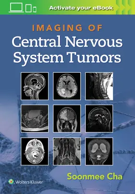 A központi idegrendszeri daganatok képalkotása - Imaging of Central Nervous System Tumors