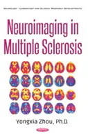 Neuroimaging a szklerózis multiplexben - Neuroimaging in Multiple Sclerosis