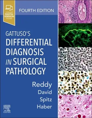 Gattuso differenciáldiagnózisa a sebészeti patológiában - Gattuso's Differential Diagnosis in Surgical Pathology