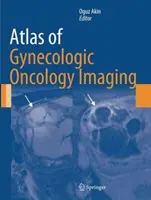 A nőgyógyászati onkológiai képalkotás atlasza - Atlas of Gynecologic Oncology Imaging