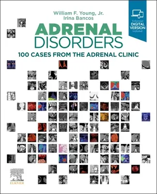 Mellékvese-rendellenességek: 100 eset a mellékveseklinikáról - Adrenal Disorders: 100 Cases from the Adrenal Clinic