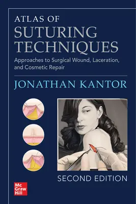 A varratszedési technikák atlasza: A sebészeti seb-, szakadás- és kozmetikai sebjavítás megközelítései, második kiadás - Atlas of Suturing Techniques: Approaches to Surgical Wound, Laceration, and Cosmetic Repair, Second Edition