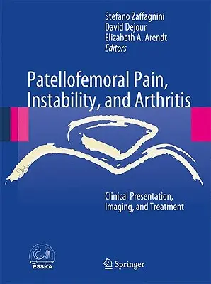 Patellofemorális fájdalom, instabilitás és ízületi gyulladás: Klinikai bemutatás, képalkotás és kezelés - Patellofemoral Pain, Instability, and Arthritis: Clinical Presentation, Imaging, and Treatment