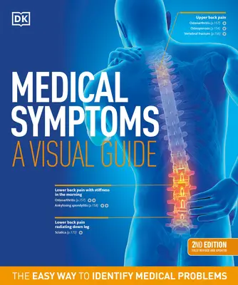 Orvosi tünetek: A Visual Guide, 2. kiadás: Az orvosi problémák azonosításának egyszerű módja - Medical Symptoms: A Visual Guide, 2nd Edition: The Easy Way to Identify Medical Problems