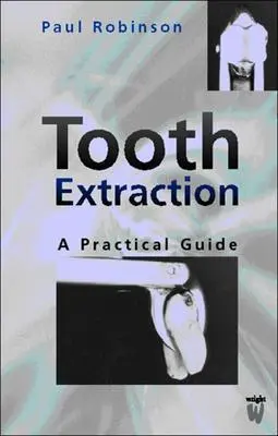 Foghúzás: Gyakorlati útmutató - Tooth Extraction: A Practical Guide