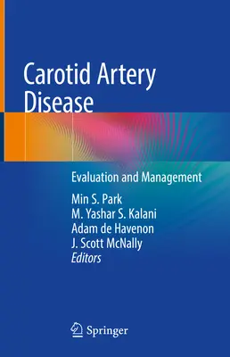 Carotis artéria betegség: Az artériás verőér: Értékelés és kezelés - Carotid Artery Disease: Evaluation and Management