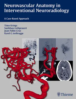 Neurovaszkuláris anatómia az intervenciós neuroradiológiában: Esetalapú megközelítés - Neurovascular Anatomy in Interventional Neuroradiology: A Case-Based Approach