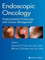 Endoszkópos onkológia - Endoscopic Oncology