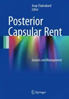 Hátsó kapszuláris bérlet: Genezis és kezelés - Posterior Capsular Rent: Genesis and Management