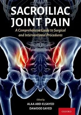 Sacroiliacalis ízületi fájdalom: Átfogó útmutató a beavatkozási és sebészeti eljárásokhoz - Sacroiliac Joint Pain: A Comprehensive Guide to Interventional and Surgical Procedures