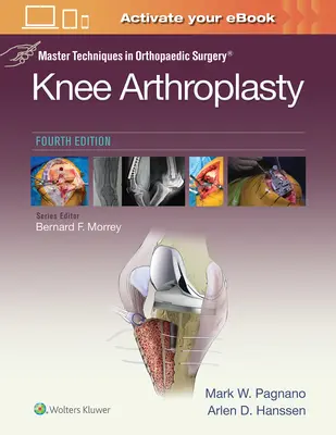 Mestertechnikák az ortopédiai sebészetben: Térdprotézisek - Master Techniques in Orthopedic Surgery: Knee Arthroplasty