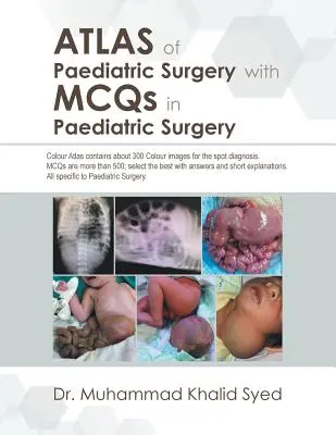 A gyermeksebészet atlasza a gyermeksebészet Mcq-kel - Atlas of Paediatric Surgery with Mcqs in Paediatric Surgery