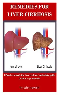 A májzsugorodás gyógymódjai: Hatékony jogorvoslatok a májzsugorodásra és biztonsági útmutató a hogyan kell eljárni - Remedies For Liver Cirrhosis: Effective remedies for liver cirrhosis and safety guide on how to go about it