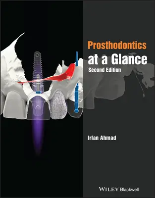 A fogszabályozás áttekintése - Prosthodontics at a Glance