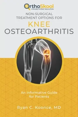 A térdízületi artritisz nem sebészeti kezelési lehetőségei: Tájékoztató útmutató a betegek számára - Non-Surgical Treatment Options for Knee Osteoarthritis: An Informative Guide for Patients