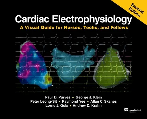 Szívelektrofiziológia: Vizuális útmutató ápolók, technikusok és ösztöndíjasok számára, második kiadás - Cardiac Electrophysiology: A Visual Guide for Nurses, Techs, and Fellows, Second Edition