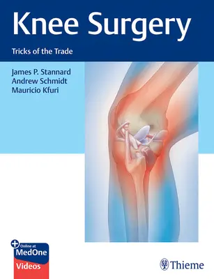 Térdműtét: A szakma trükkjei - Knee Surgery: Tricks of the Trade