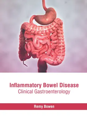 Gyulladásos bélbetegség: Klinikai gasztroenterológia - Inflammatory Bowel Disease: Clinical Gastroenterology