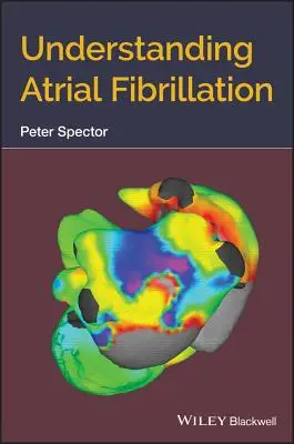 A pitvarfibrilláció megértése - Understanding Atrial Fibrillation