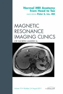Normális MR-anatómia a fejtől a lábujjakig, a Magnetic Resonance Imaging Clinics kiadványa: 19-3. kötet - Normal MR Anatomy from Head to Toe, an Issue of Magnetic Resonance Imaging Clinics: Volume 19-3