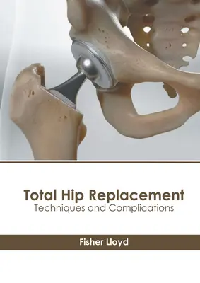 Teljes csípőprotézis-beültetés: Technikák és szövődmények - Total Hip Replacement: Techniques and Complications