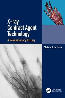 X-Ray Contrast Agent Technology: Forradalmi történelem - X-Ray Contrast Agent Technology: A Revolutionary History