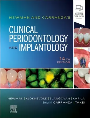 Newman és Carranza klinikai parodontológia és implantológia - Newman and Carranza's Clinical Periodontology and Implantology