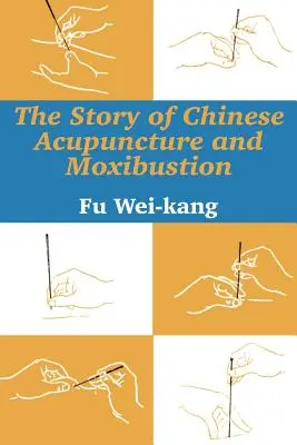 A kínai akupunktúra és a moxibustion története - The Story of Chinese Acupuncture and Moxibustion