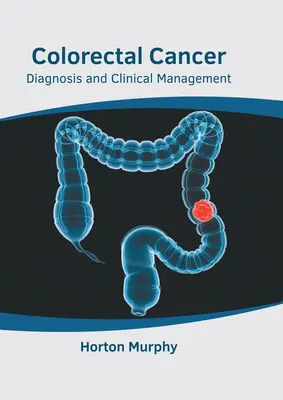 Vastagbélrák: Kolorektális vastagbélbetegség: Diagnózis és klinikai kezelés - Colorectal Cancer: Diagnosis and Clinical Management