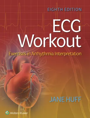 EKG edzés: Gyakorlatok az aritmia értelmezésében - ECG Workout: Exercises in Arrhythmia Interpretation