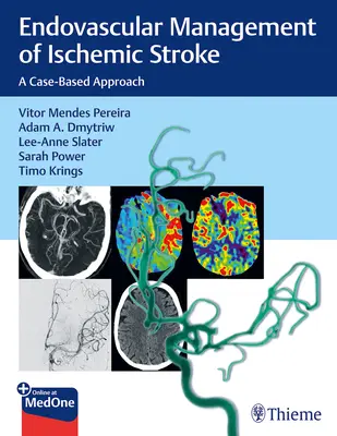 Az iszkémiás stroke endovaszkuláris kezelése: A Case-Based Approach - Endovascular Management of Ischemic Stroke: A Case-Based Approach