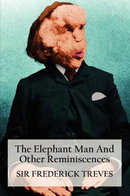 Az elefántember és más emlékek - The Elephant Man and Other Reminiscences