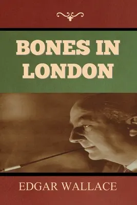 Csonti Londonban - Bones in London