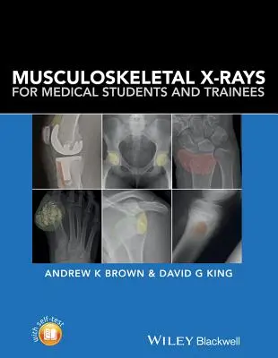 Mozgásszervi röntgenfelvételek orvostanhallgatók és gyakornokok számára - Musculoskeletal X-Rays for Medical Students and Trainees