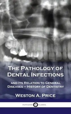 A fogászati fertőzések patológiája: és kapcsolata az általános betegségekkel - A fogászat története - Pathology of Dental Infections: and Its Relation to General Diseases - History of Dentistry