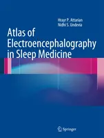 Az elektroenkefalográfia atlasza az alvásgyógyászatban - Atlas of Electroencephalography in Sleep Medicine